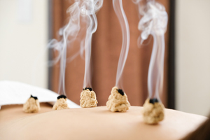 moxibustion treatment with herbal medicine burning on back of client